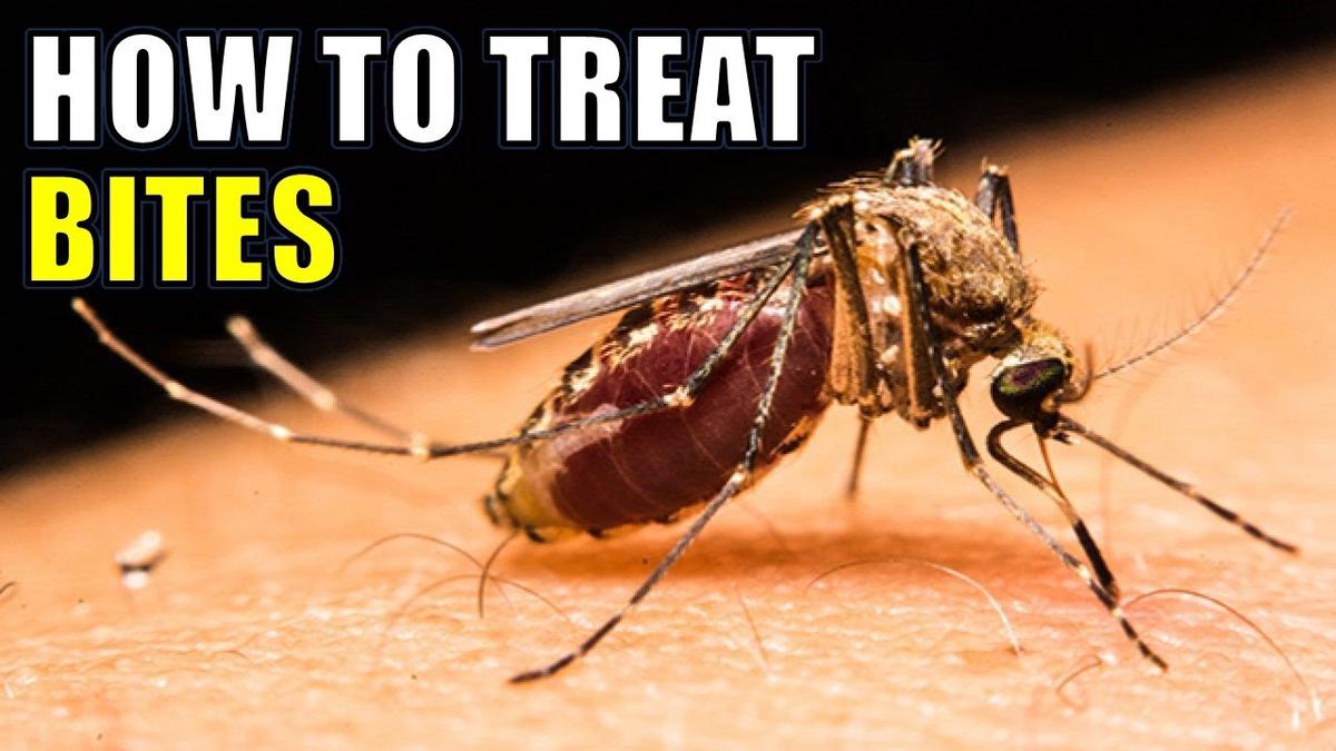 mosquito-bites-14-effective-home-remedies-for-treating-mosquito-bites