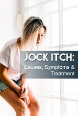 jock itch symptoms