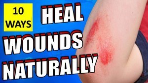 10 Natural Ways To Heal Wounds And Scrapes Fast & Quickly - Epic ...