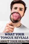 What Your Tongue Reveals About Your Health !! - Epic Natural Health