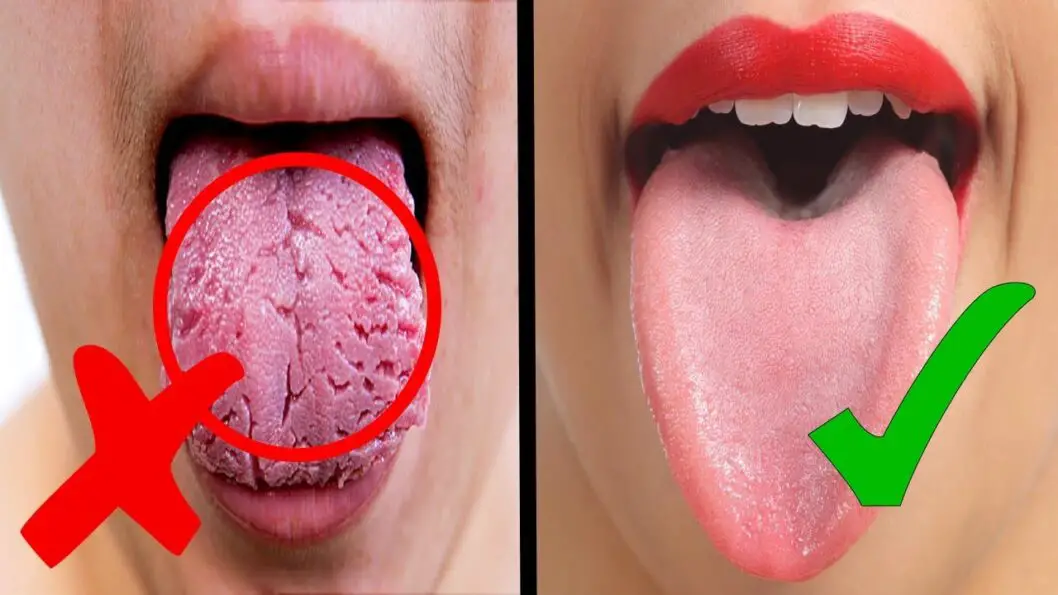 What Your Tongue Reveals About Your Health !! - Epic Natural Health