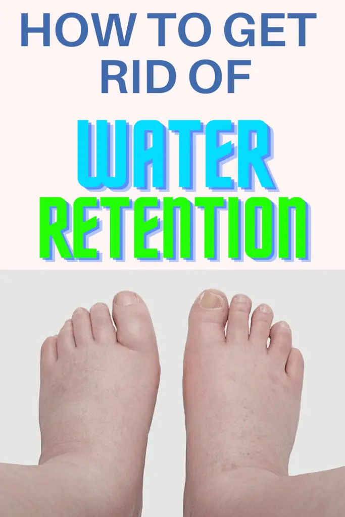 How To Get Rid Of Water Retention Fast in The Body Naturally - Epic ...