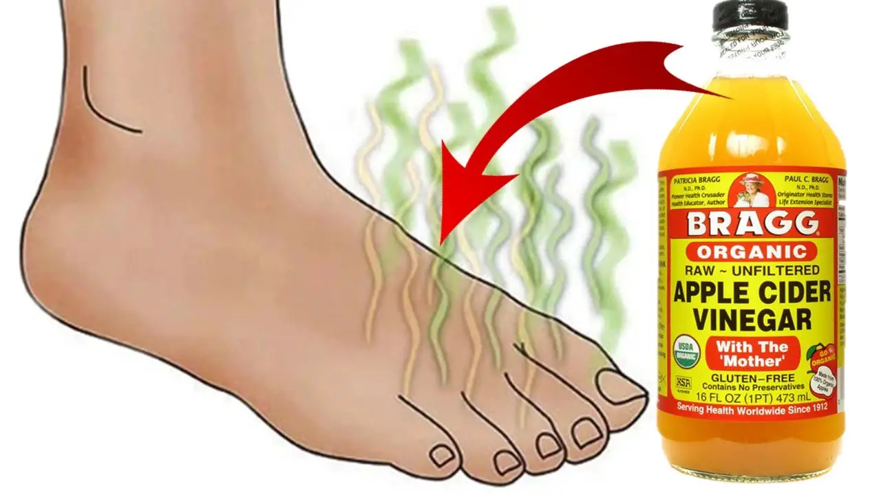 How To Easily Get Rid of Smelly Feet With Apple Cider Vinegar Epic Natural Health