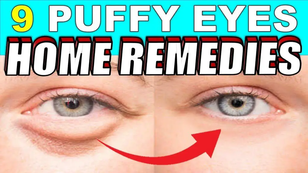9 Quick Home Remedies To Treat Puffy Eyes And Bags Naturally Causes Of Puffy Eyes Epic Natural
