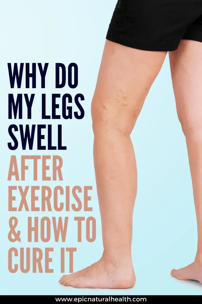 why-do-my-legs-swell-up-after-exercise-how-to-cure-leg-swelling-pain