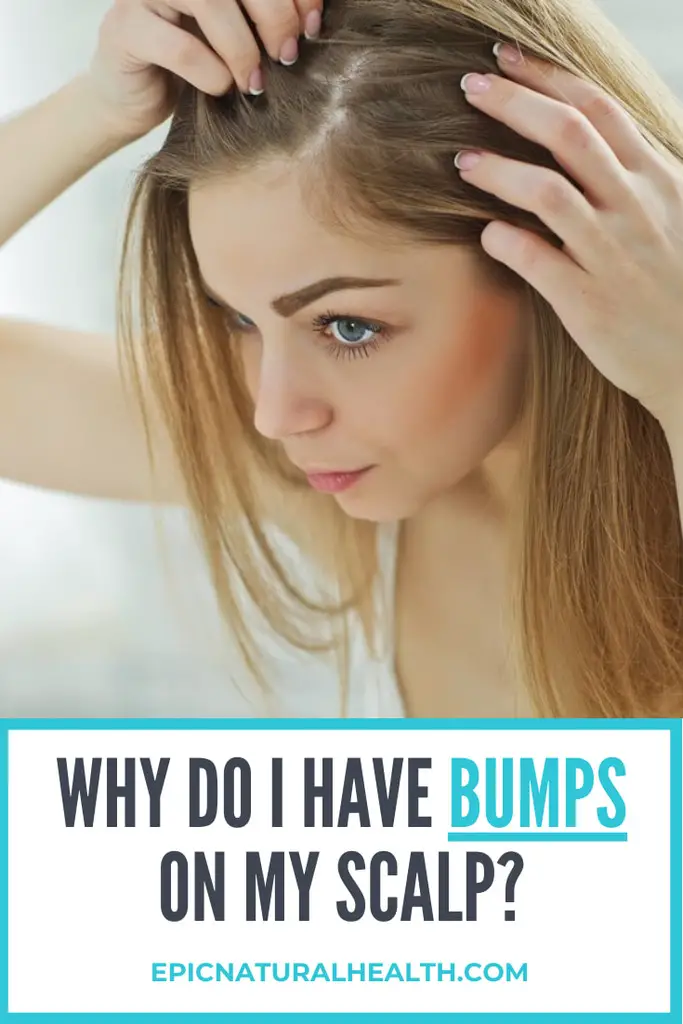 Why Do I Have Bumps on My Scalp | How To Get Rid of Scalp Acne ...