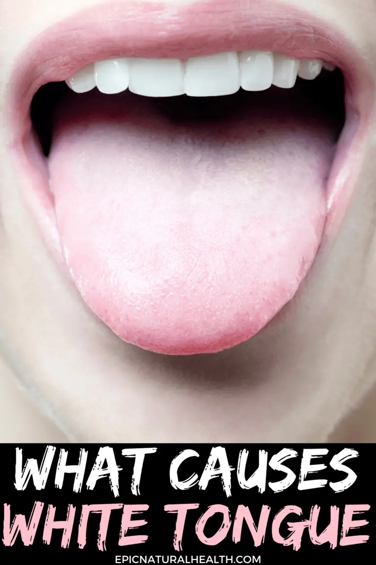 What Causes White Tongue How To Get Rid Of White Tongue Quickly