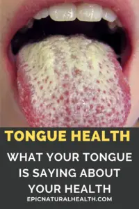 What Your Tongue Reveals About Your Health - Epic Natural Health