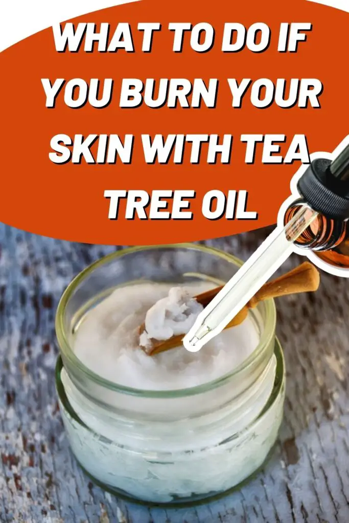 What To Do If You Burn Your Skin With Tea Tree Oil - Epic Natural Health