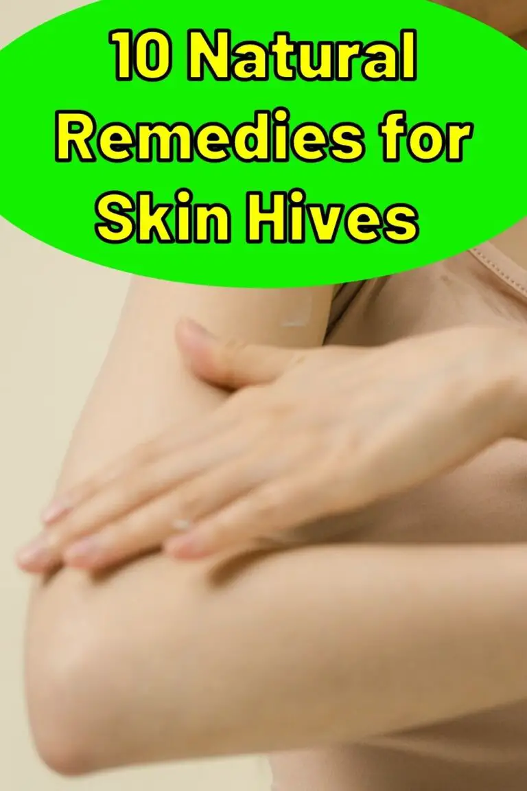 10-natural-remedies-for-skin-hives-treatment-at-home-what-are-skin