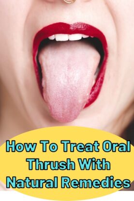 How To Treat Oral Thrush With Natural Remedies - Epic Natural Health